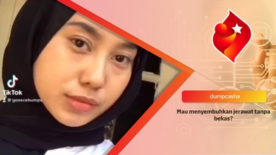 Tutorial Menghilangkan Jerawat