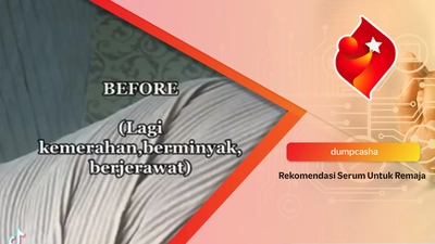 Rekomendasi Serum untuk Remaja